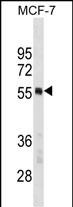WB - PTBP1 Antibody(N-term) AP19710a